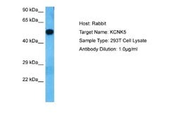 KCNK5 Rabbit anti-Human, Polyclonal, Novus Biologicals 0.1ml; Unconjugated:Antibodies,